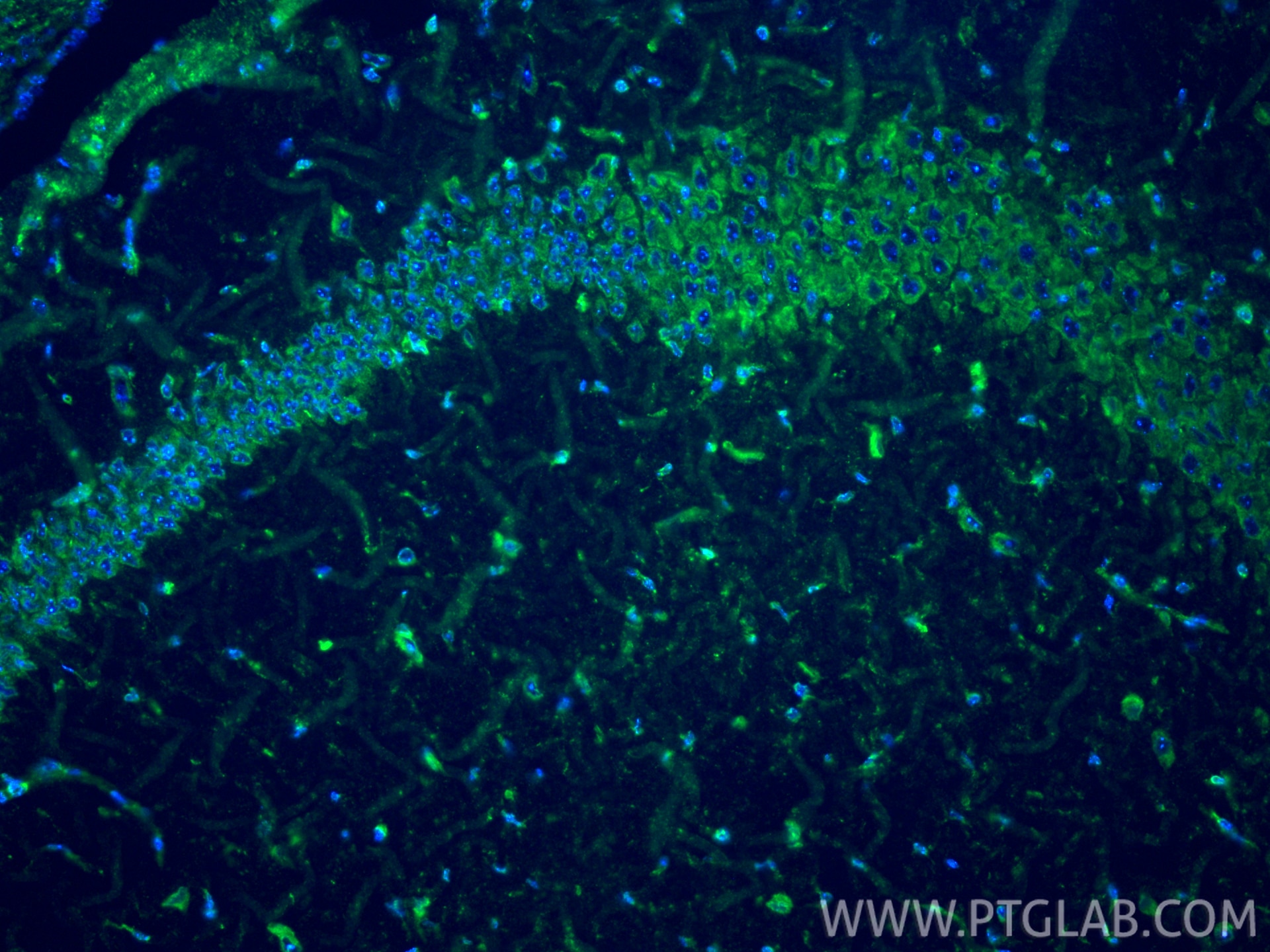 Immunofluorescence (IF) / fluorescent staining of mouse brain tissue using Apelin Polyclonal antibody (11497-1-AP)