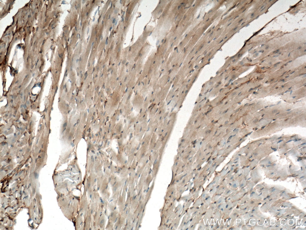 Immunohistochemistry (IHC) staining of mouse heart tissue using Apelin Polyclonal antibody (11497-1-AP)