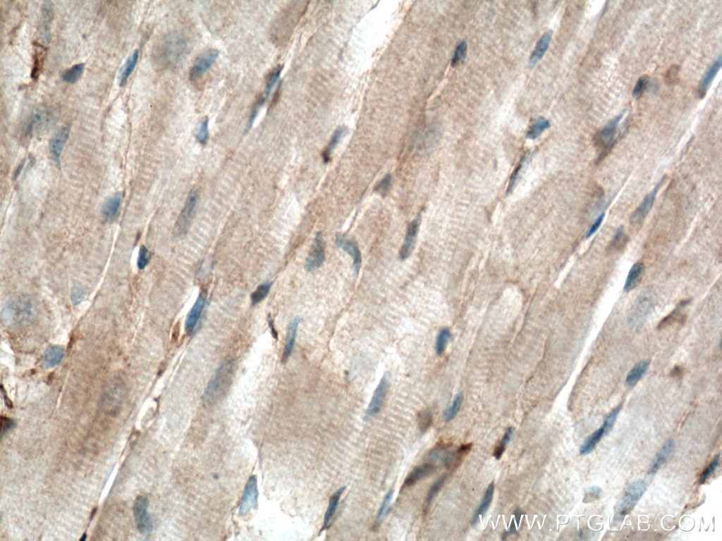 Immunohistochemistry (IHC) staining of mouse heart tissue using Apelin Polyclonal antibody (11497-1-AP)