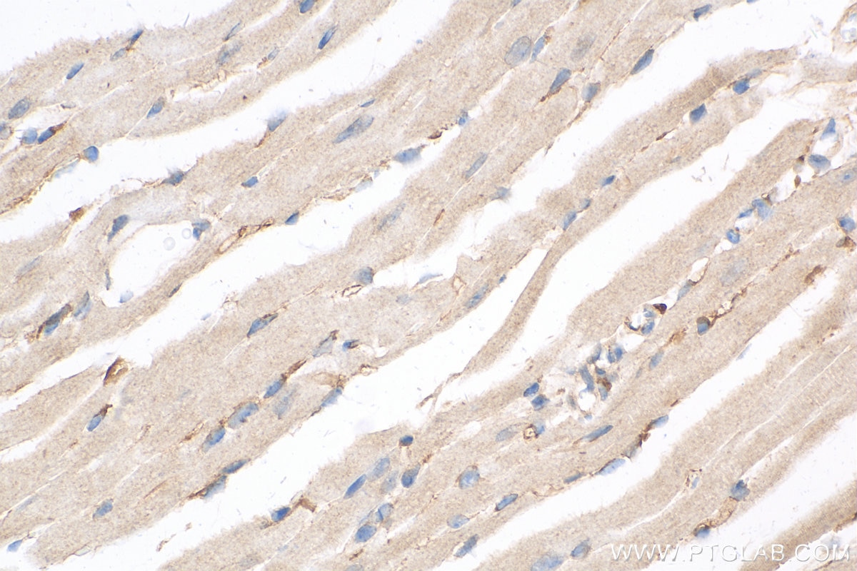 Immunohistochemistry (IHC) staining of mouse heart tissue using Apelin Polyclonal antibody (11497-1-AP)