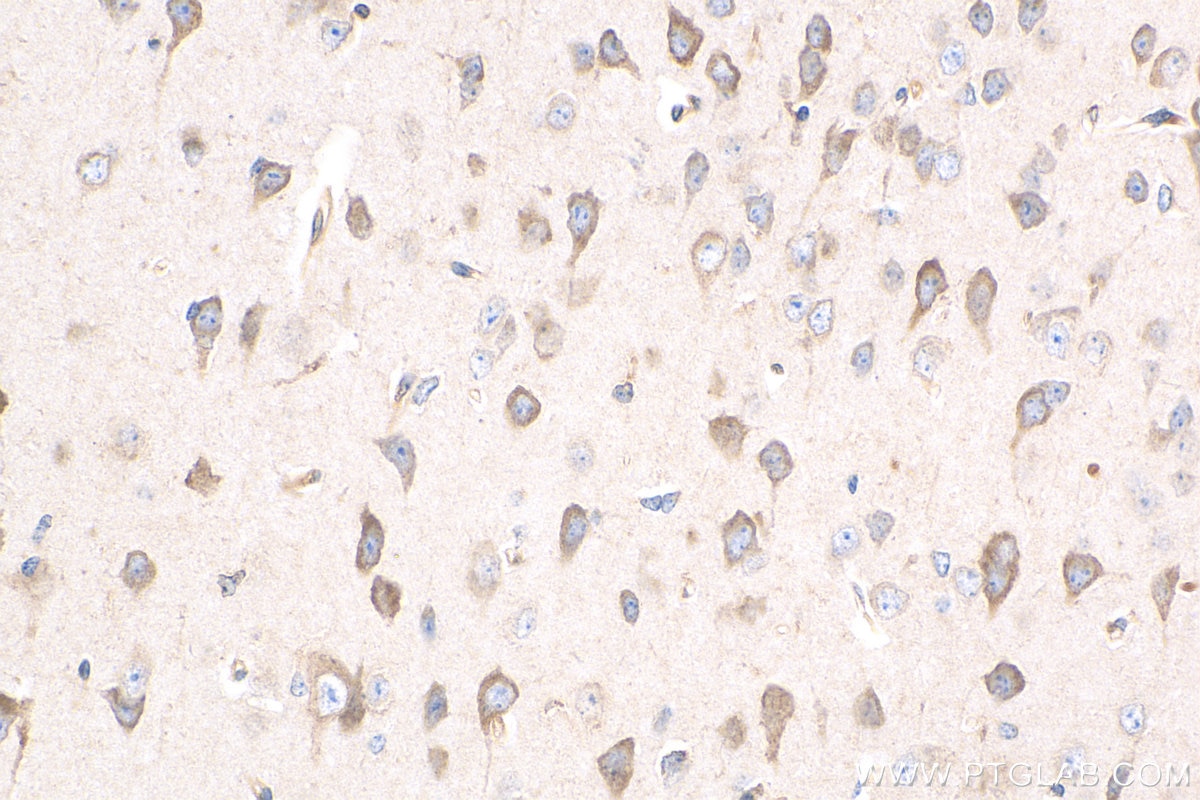 Immunohistochemistry (IHC) staining of mouse brain tissue using Apelin Polyclonal antibody (11497-1-AP)