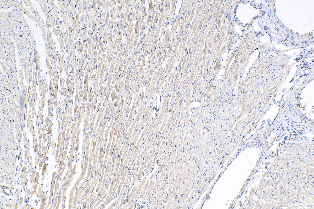 Immunohistochemistry (IHC) staining of rat heart tissue using Apelin Polyclonal antibody (11497-1-AP)