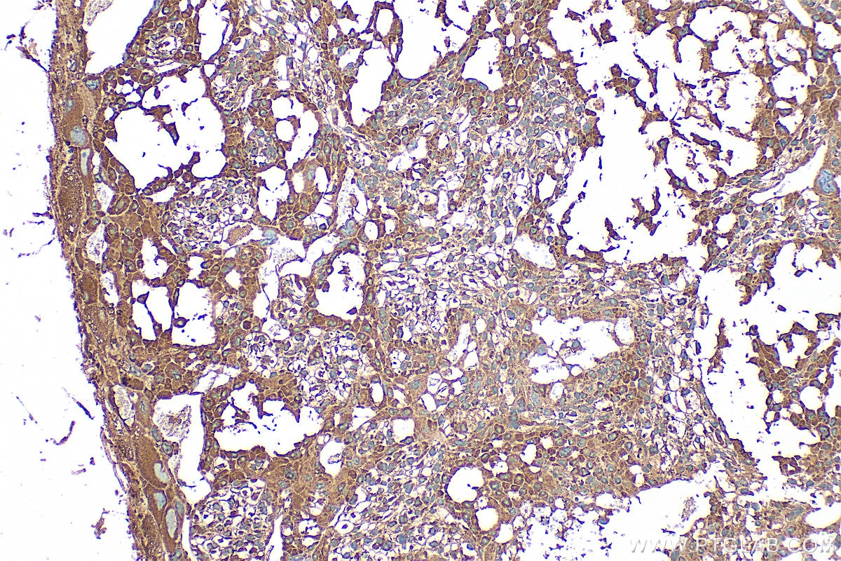 Immunohistochemistry (IHC) staining of mouse placenta tissue using Apelin Polyclonal antibody (11497-1-AP)