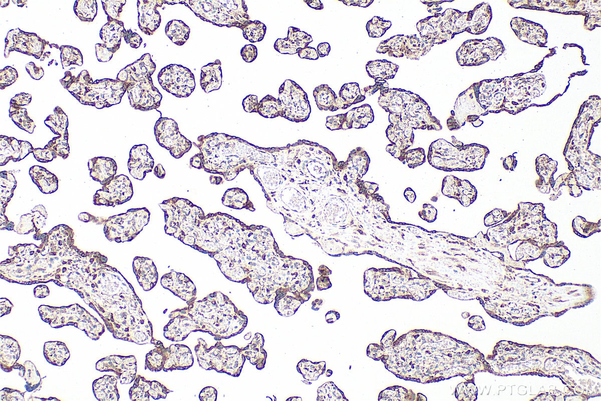 Immunohistochemistry (IHC) staining of human placenta tissue using Apelin Polyclonal antibody (11497-1-AP)