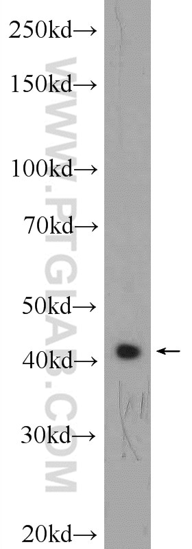 Western Blot (WB) analysis of SH-SY5Y cells using APJ Polyclonal antibody (20341-1-AP)