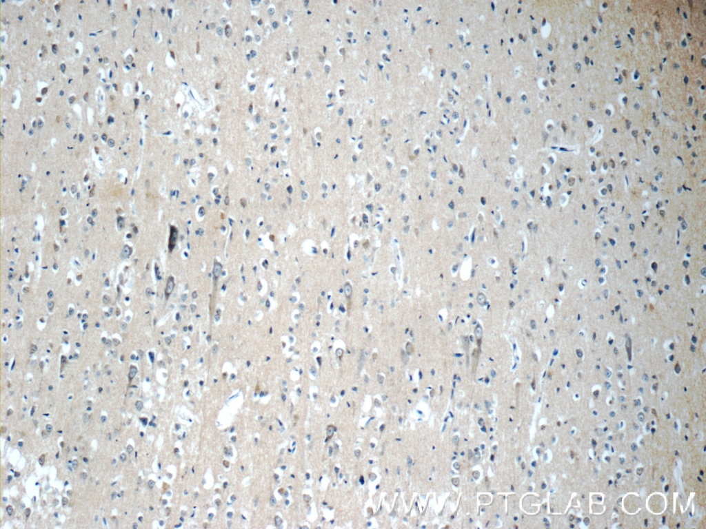 IHC staining of human brain using 12305-2-AP