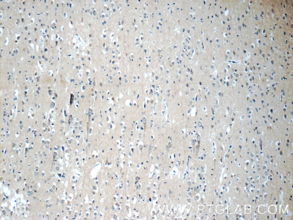 Immunohistochemistry (IHC) staining of human brain tissue using APLP1 Polyclonal antibody (12305-2-AP)