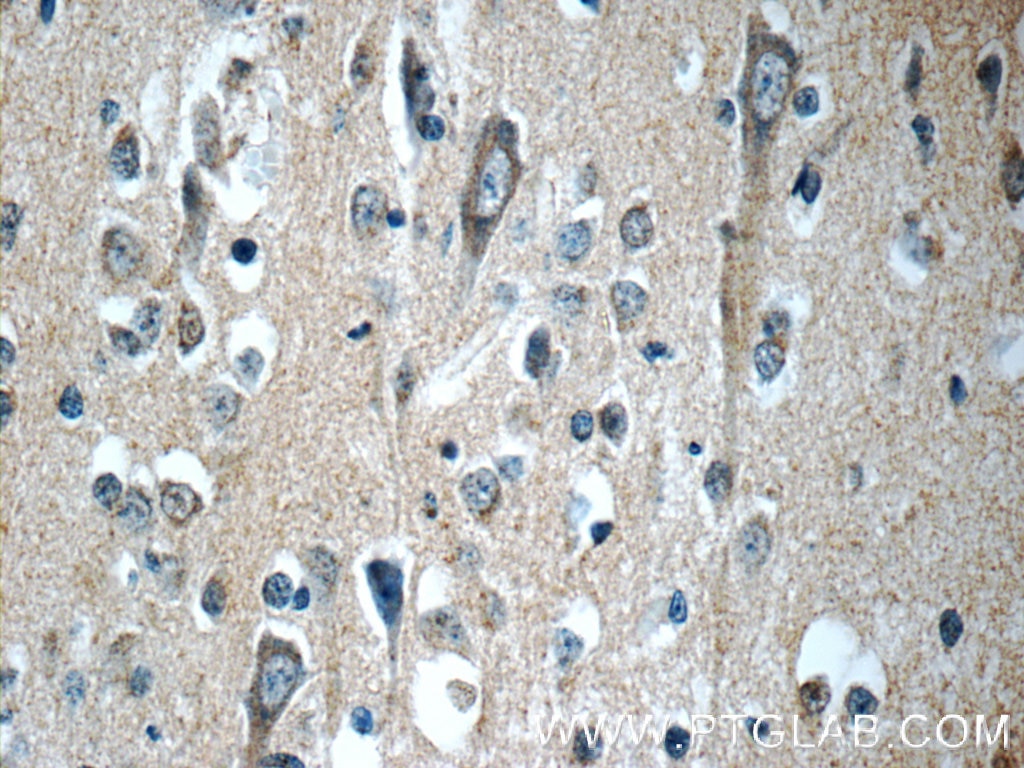 Immunohistochemistry (IHC) staining of human brain tissue using APLP1 Polyclonal antibody (12305-2-AP)