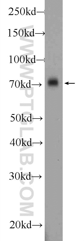 Western Blot (WB) analysis of mouse brain tissue using APLP1 Polyclonal antibody (12305-2-AP)