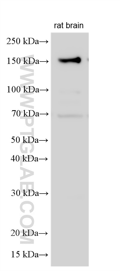 Western Blot (WB) analysis of various lysates using APLP1 Polyclonal antibody (12305-2-AP)