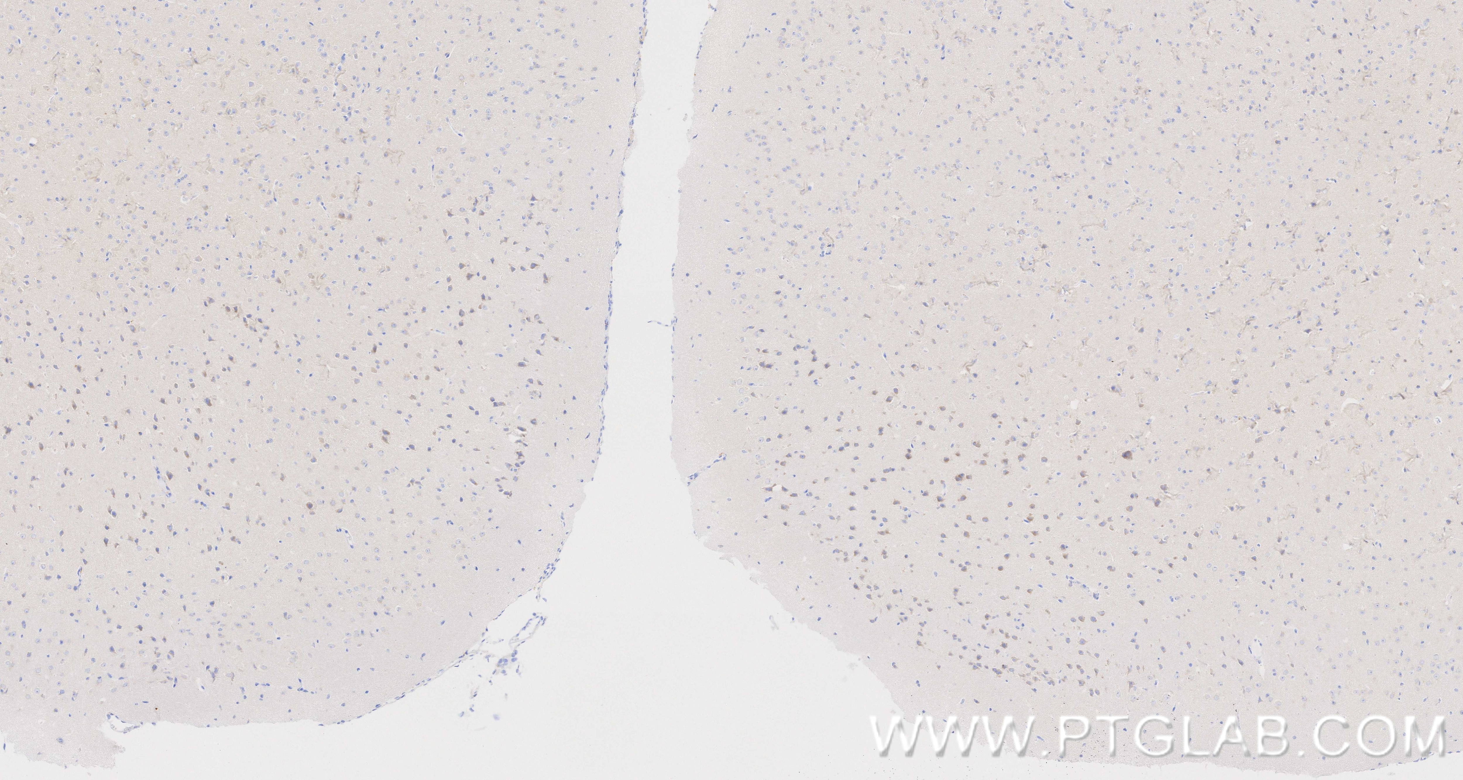 Immunohistochemistry (IHC) staining of mouse brain tissue using APLP1 Recombinant monoclonal antibody (87113-1-RR)