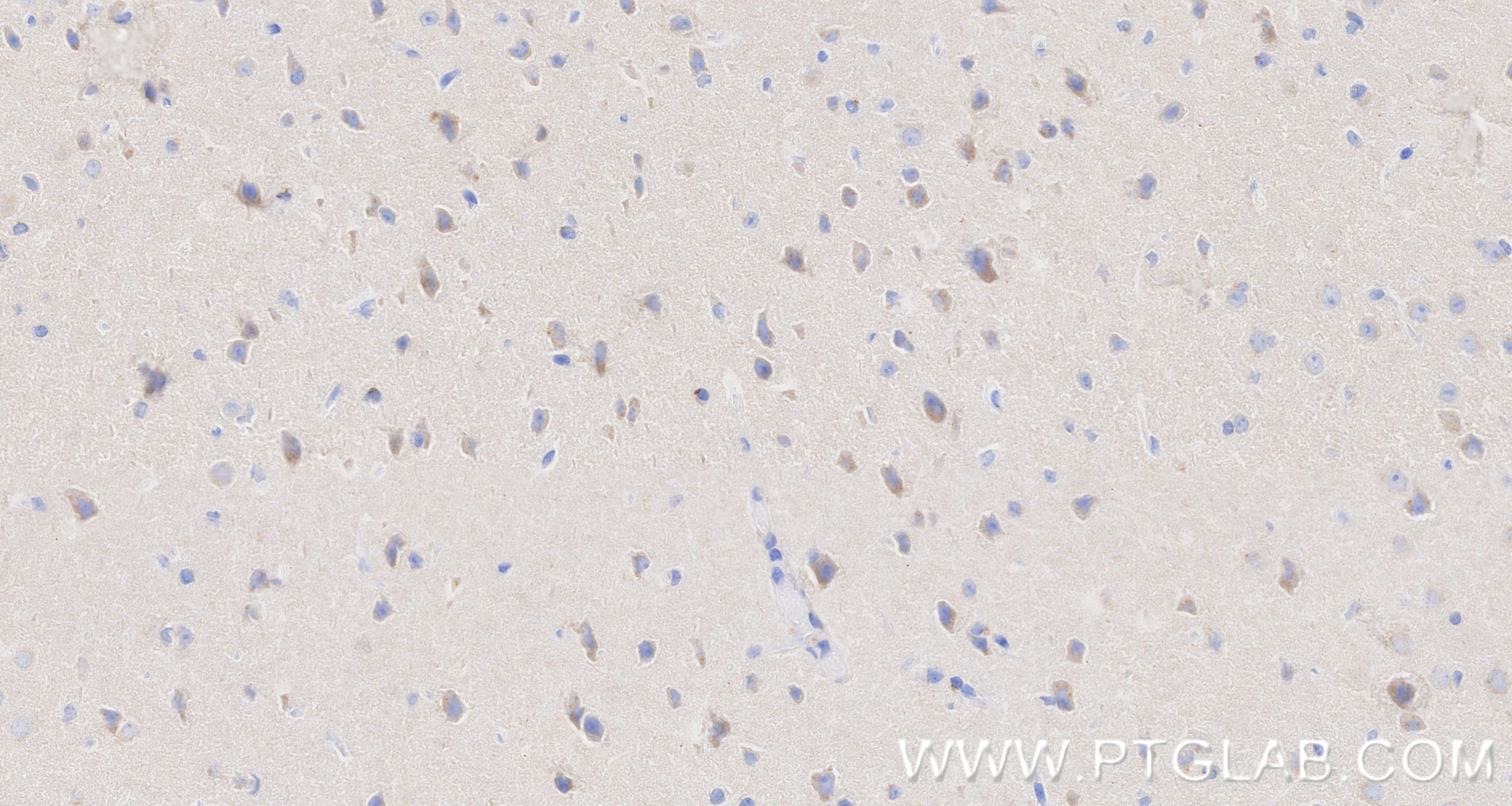 Immunohistochemistry (IHC) staining of mouse brain tissue using APLP1 Recombinant monoclonal antibody (87113-1-RR)