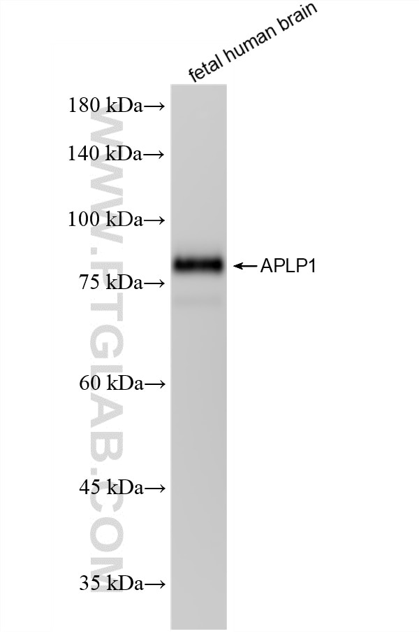 Western Blot (WB) analysis of fetal human brain tissue using APLP1 Recombinant monoclonal antibody (87113-1-RR)
