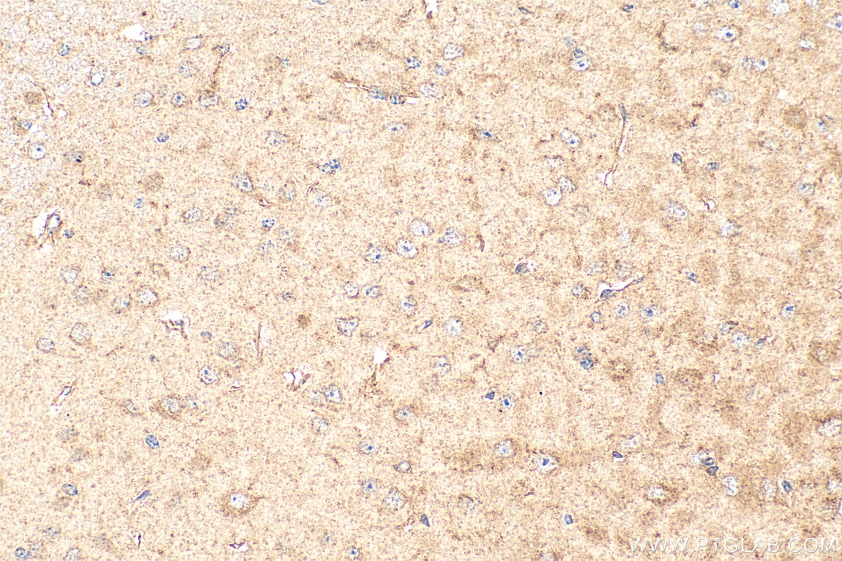 Immunohistochemistry (IHC) staining of mouse brain tissue using APLP2 Polyclonal antibody (15041-1-AP)