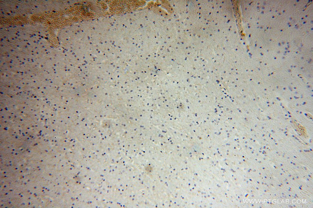 Immunohistochemistry (IHC) staining of human brain tissue using APLP2 Polyclonal antibody (15041-1-AP)