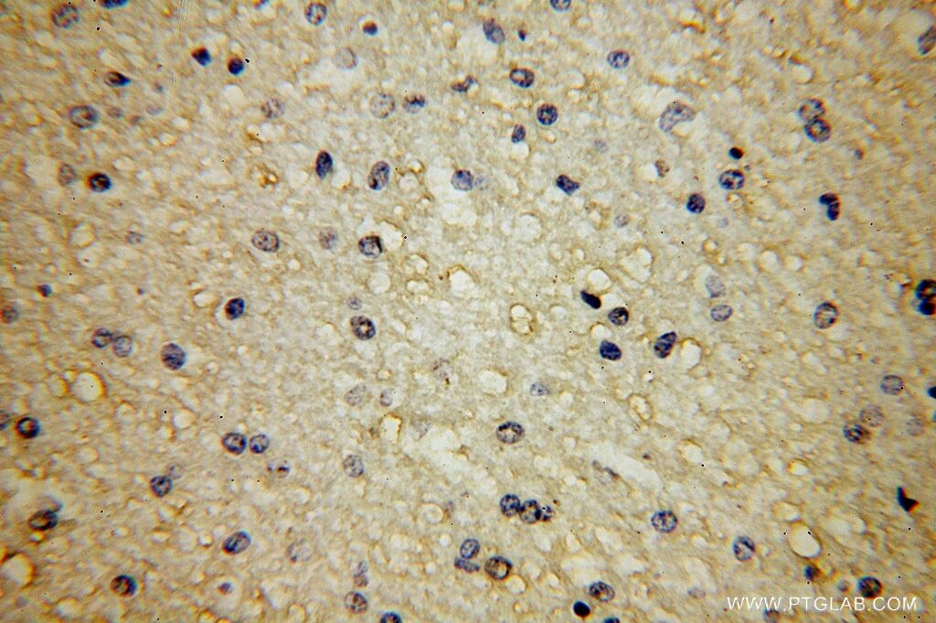 Immunohistochemistry (IHC) staining of human brain tissue using APLP2 Polyclonal antibody (15041-1-AP)