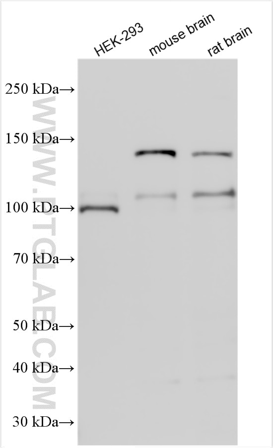 Western Blot (WB) analysis of various lysates using APLP2 Polyclonal antibody (15041-1-AP)