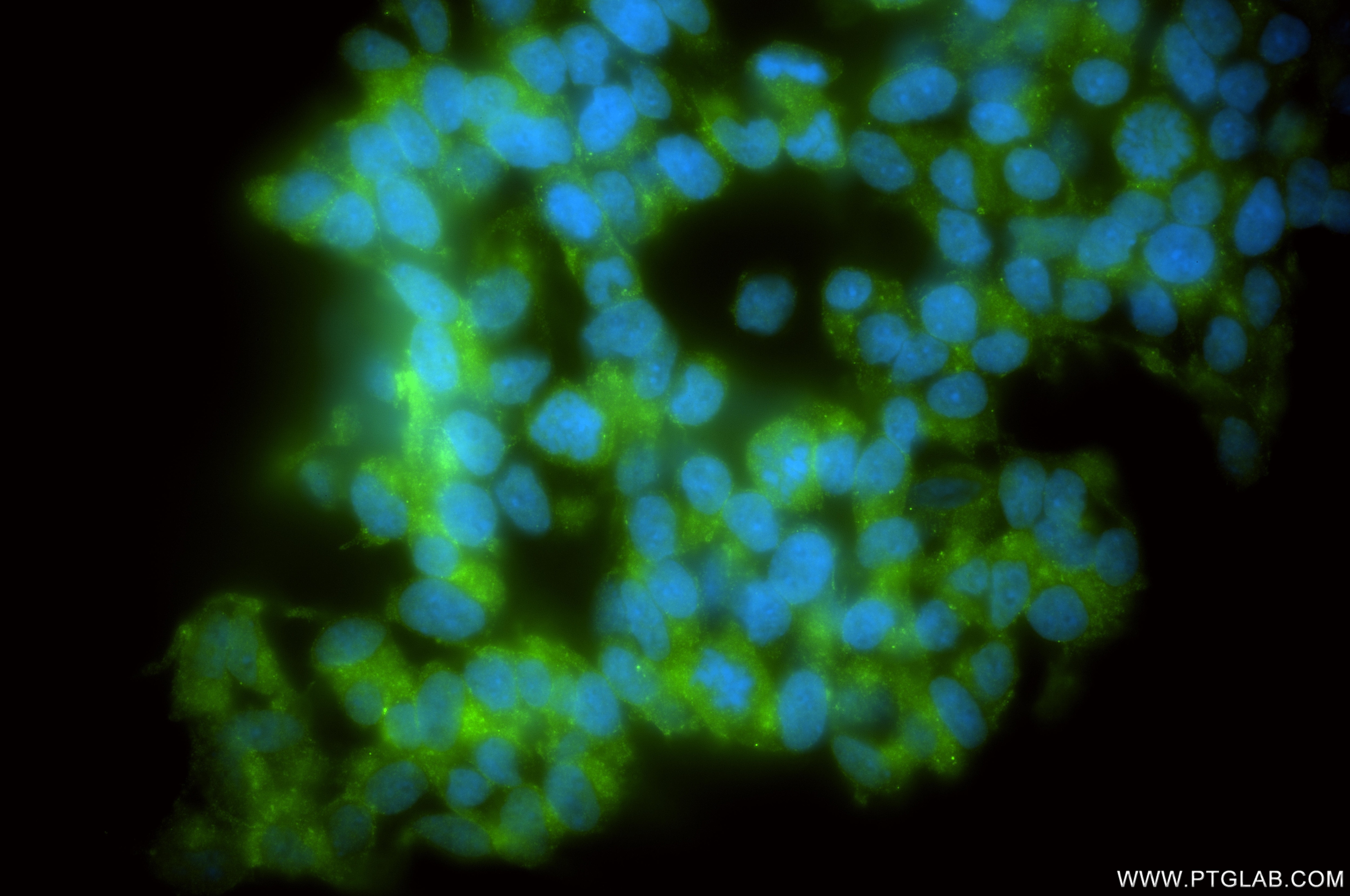 Immunofluorescence (IF) / fluorescent staining of SH-SY5Y cells using APLP2 Recombinant monoclonal antibody (84703-3-RR)