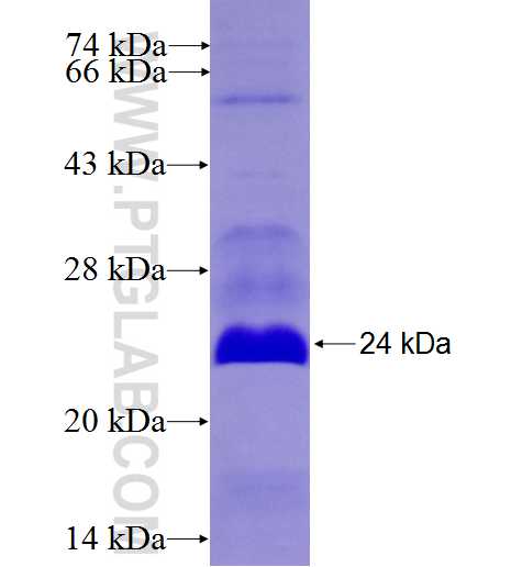 APLP2 fusion protein Ag27038 SDS-PAGE