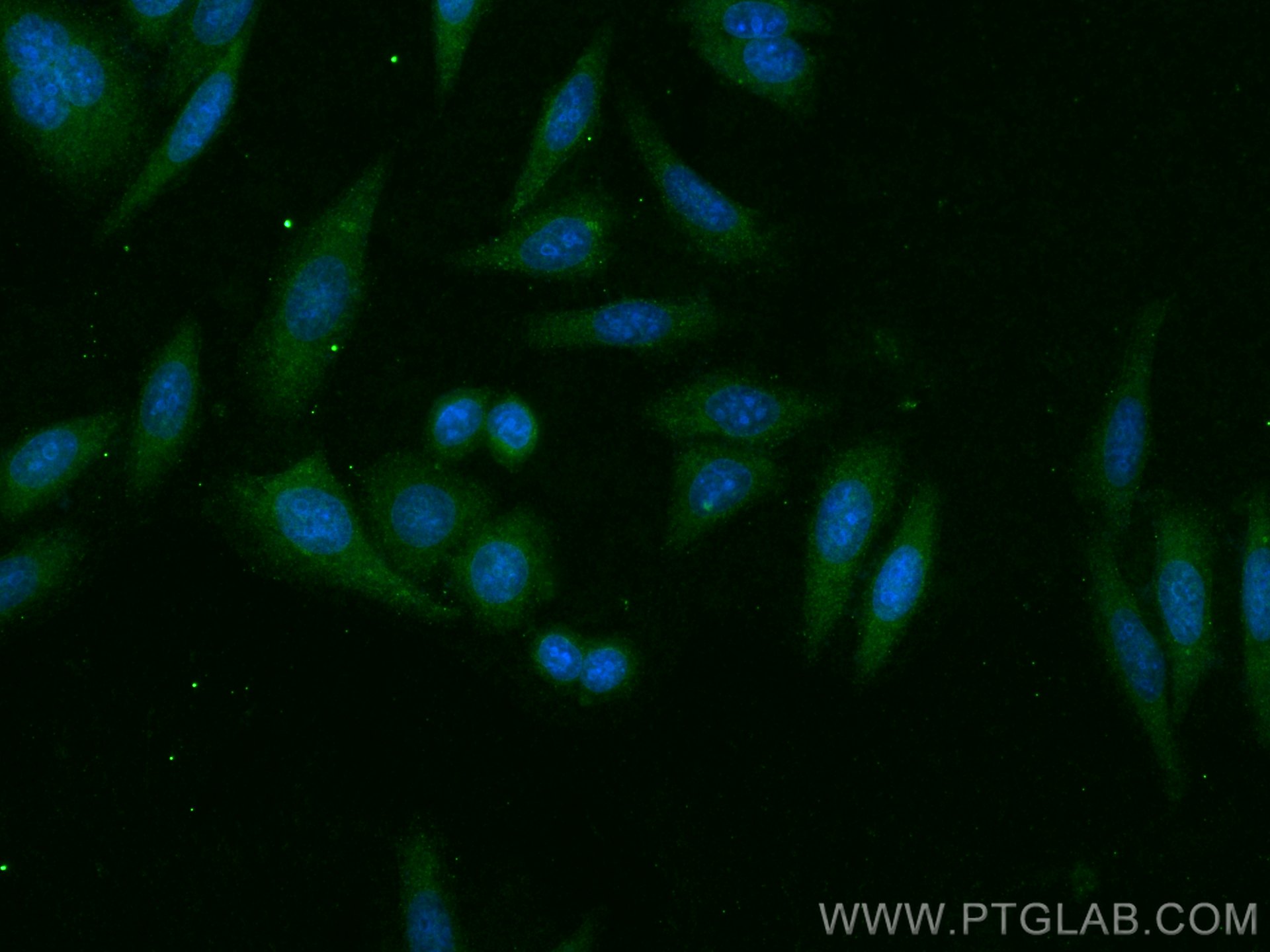 Apolipoprotein AI