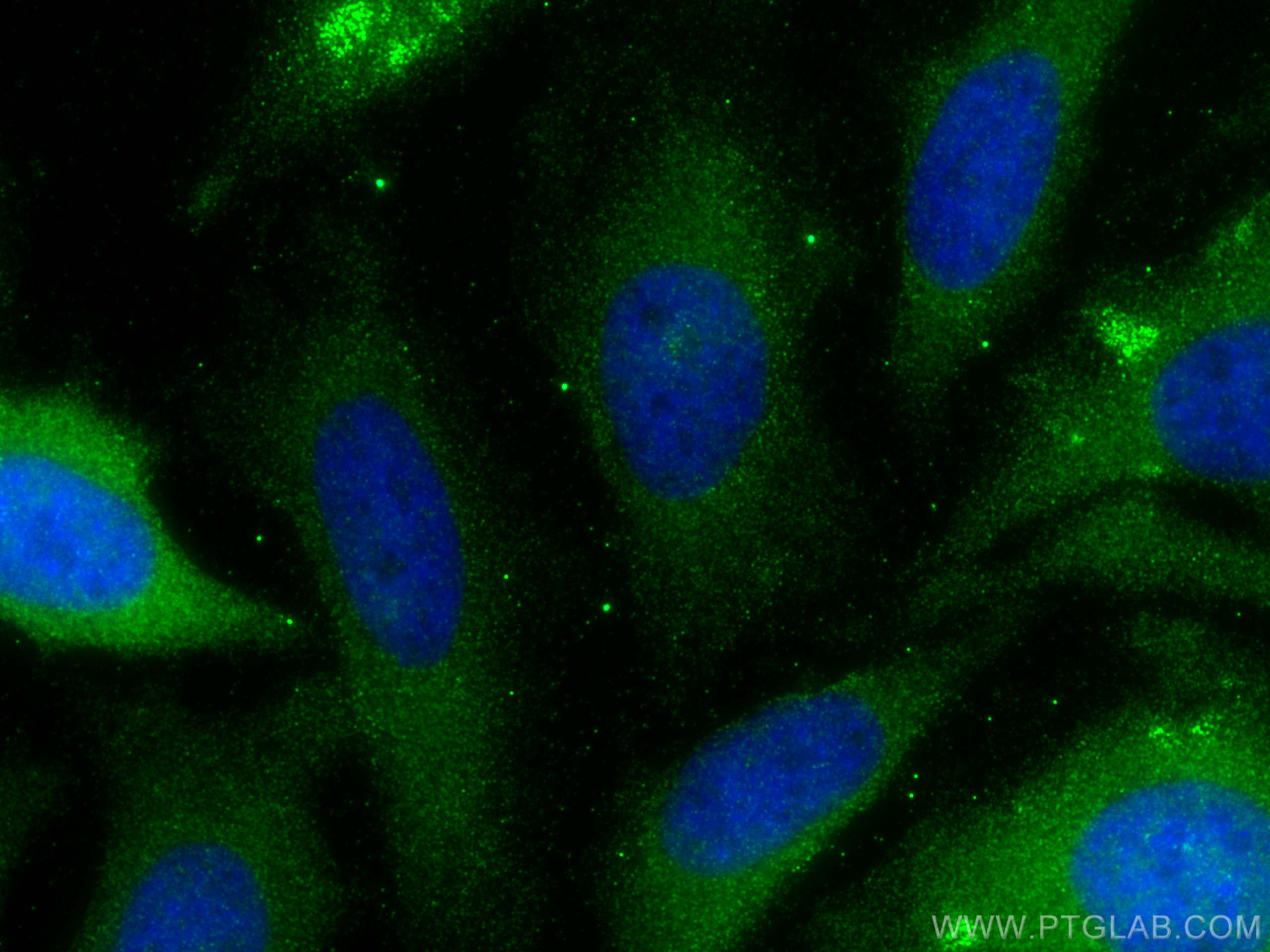 Immunofluorescence (IF) / fluorescent staining of HeLa cells using Apolipoprotein AI Polyclonal antibody (14427-1-AP)