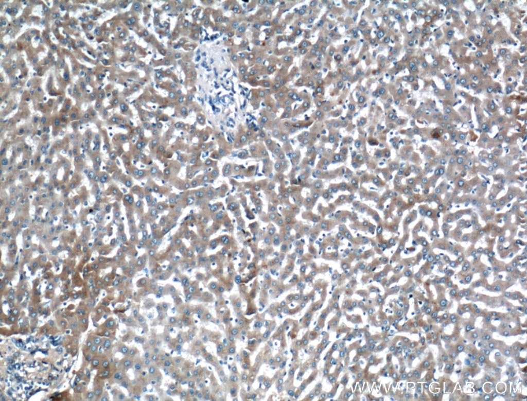 Immunohistochemistry (IHC) staining of human liver tissue using Apolipoprotein AI Polyclonal antibody (14427-1-AP)