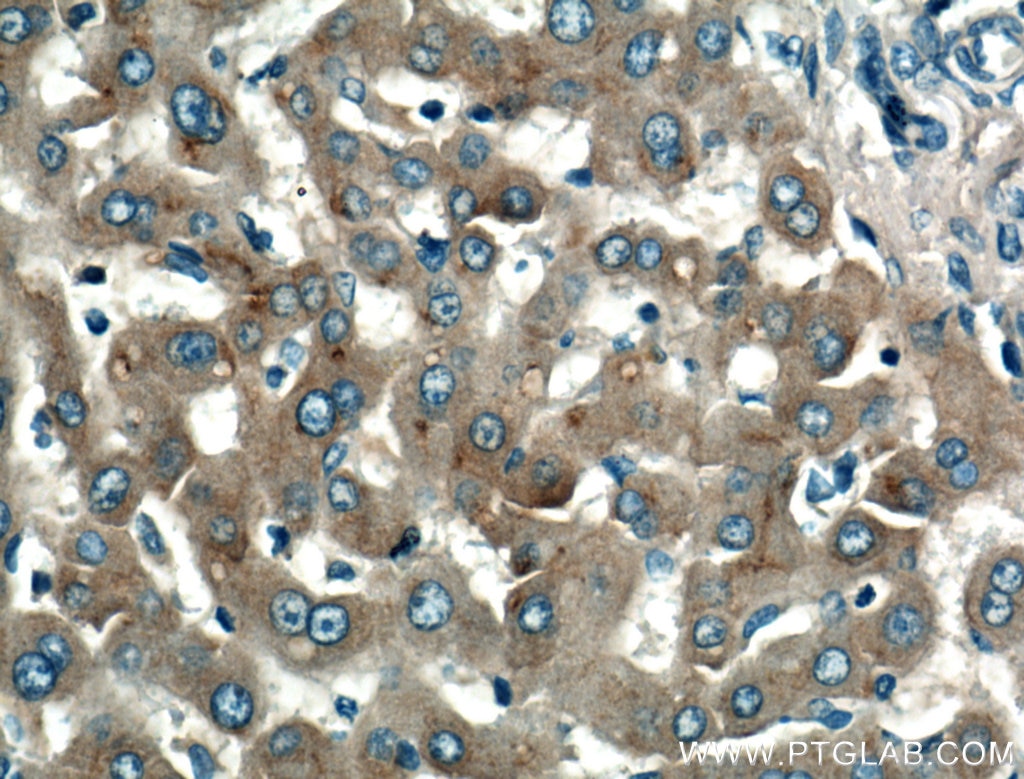 Immunohistochemistry (IHC) staining of human liver tissue using Apolipoprotein AI Polyclonal antibody (14427-1-AP)