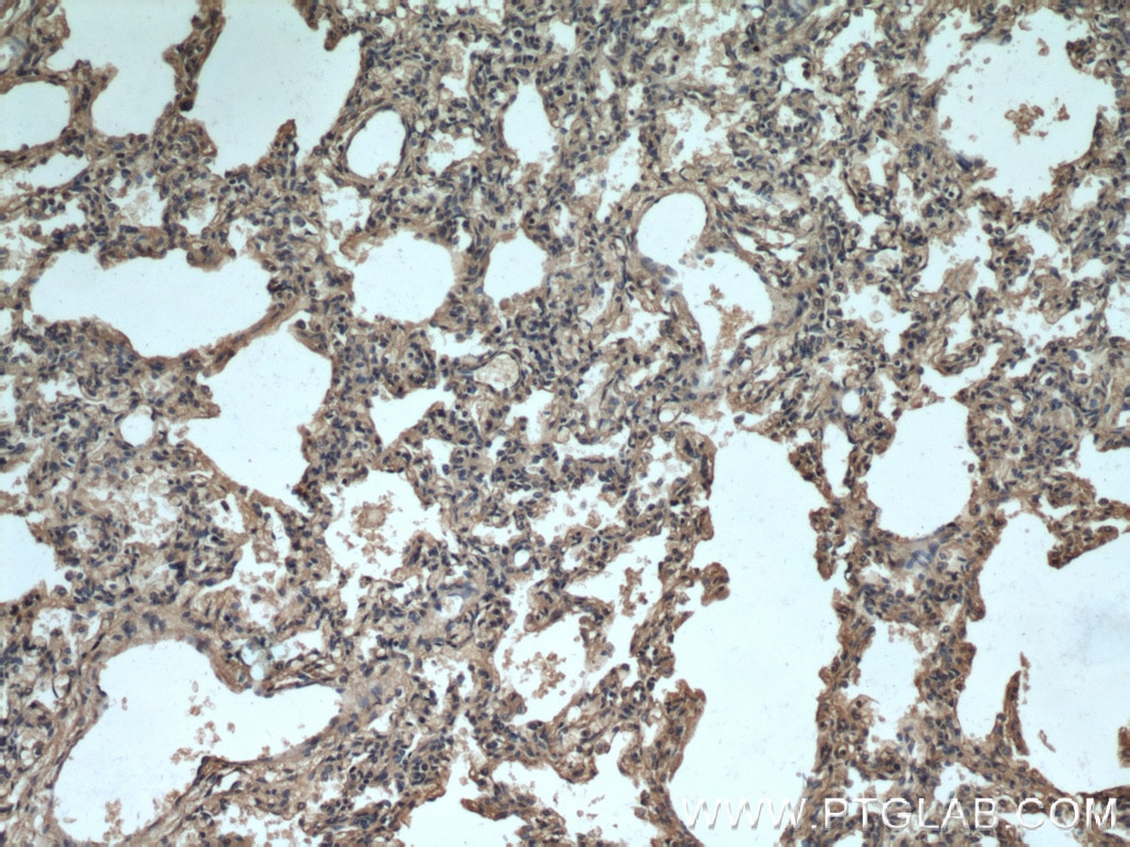 Immunohistochemistry (IHC) staining of human lung tissue using Apolipoprotein AI Polyclonal antibody (14427-1-AP)