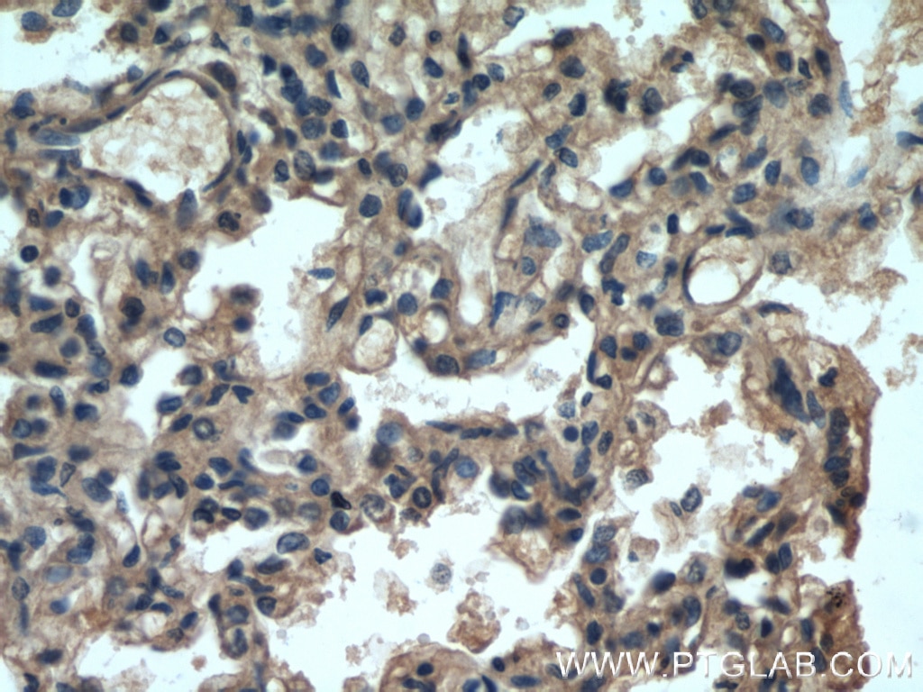 Immunohistochemistry (IHC) staining of human lung tissue using Apolipoprotein AI Polyclonal antibody (14427-1-AP)