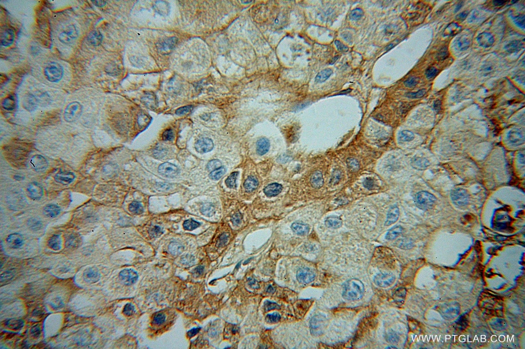 Apolipoprotein AI Polyclonal antibody