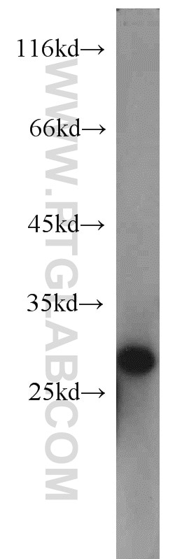 Western Blot (WB) analysis of human brain tissue using Apolipoprotein AI Polyclonal antibody (14427-1-AP)