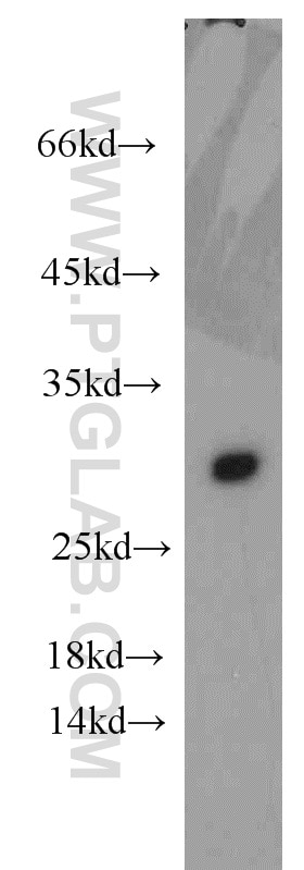 Western Blot (WB) analysis of human plasma using Apolipoprotein AI Polyclonal antibody (14427-1-AP)