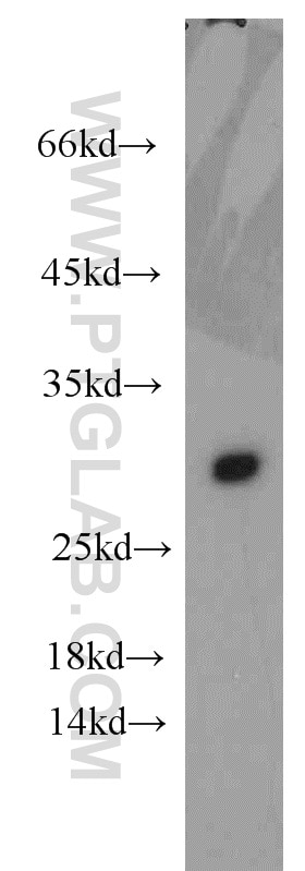 WB analysis of human plasma using 14427-1-AP