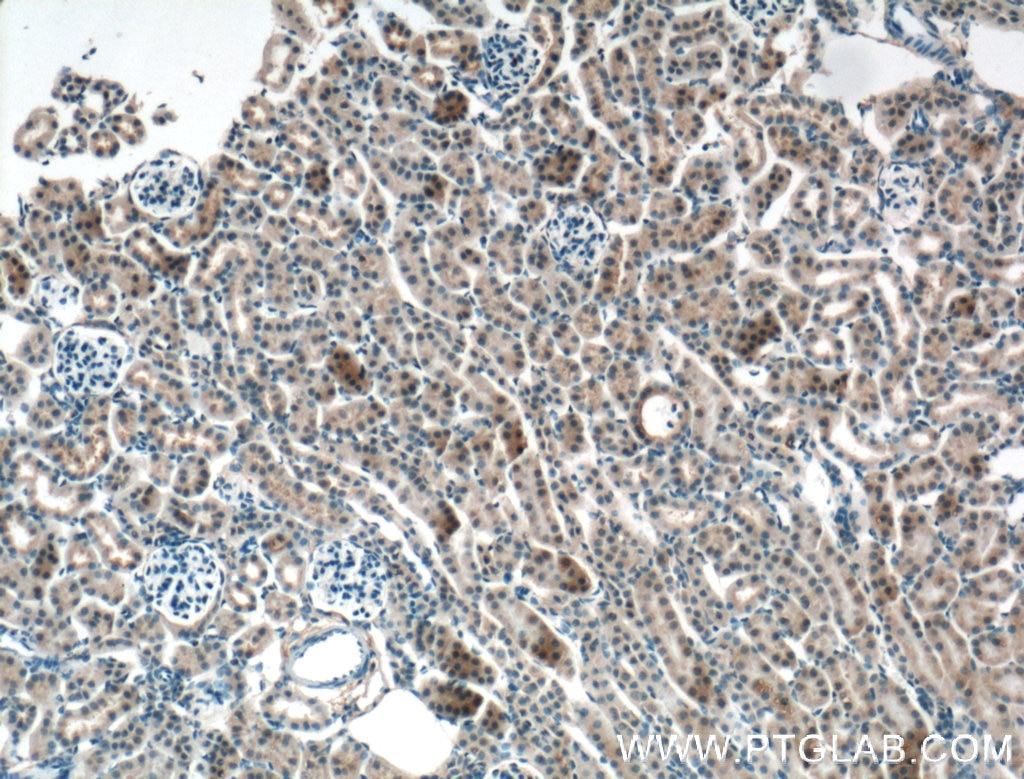 Immunohistochemistry (IHC) staining of mouse kidney tissue using Apolipoprotein AI Monoclonal antibody (66206-1-Ig)