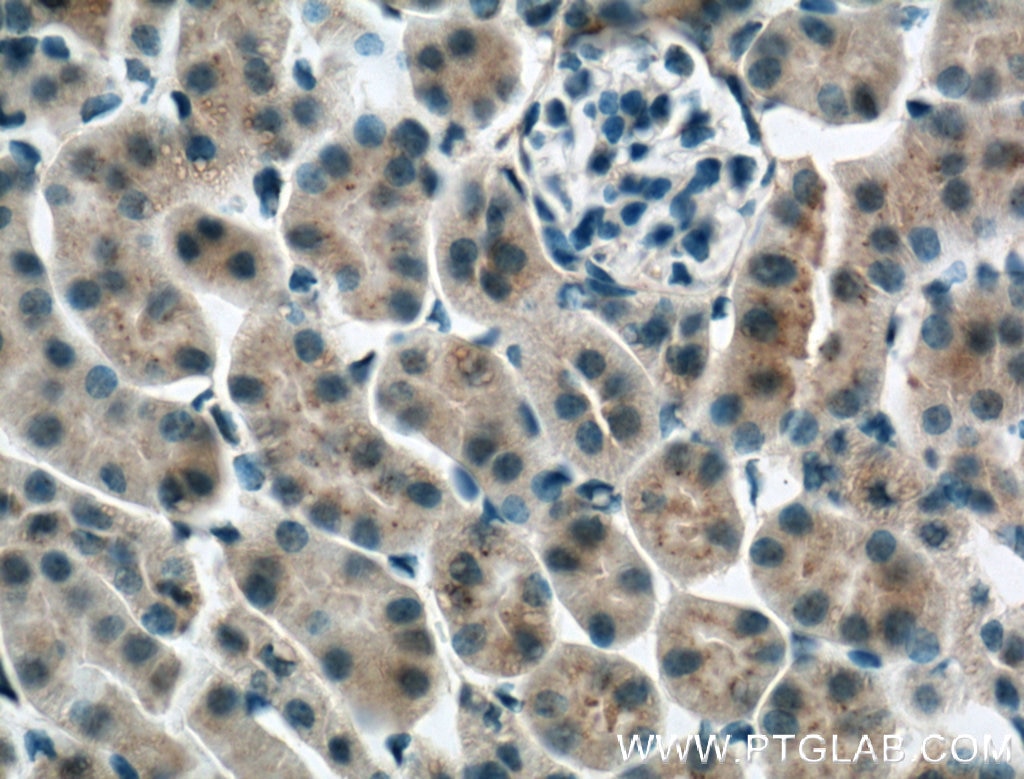 Immunohistochemistry (IHC) staining of mouse kidney tissue using Apolipoprotein AI Monoclonal antibody (66206-1-Ig)