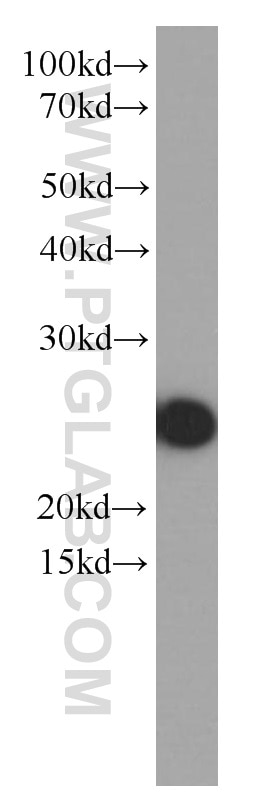 Western Blot (WB) analysis of human plasma using Apolipoprotein AI Monoclonal antibody (66206-1-Ig)