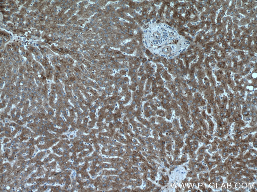 Immunohistochemistry (IHC) staining of human liver tissue using Apolipoprotein A II Polyclonal antibody (16845-1-AP)