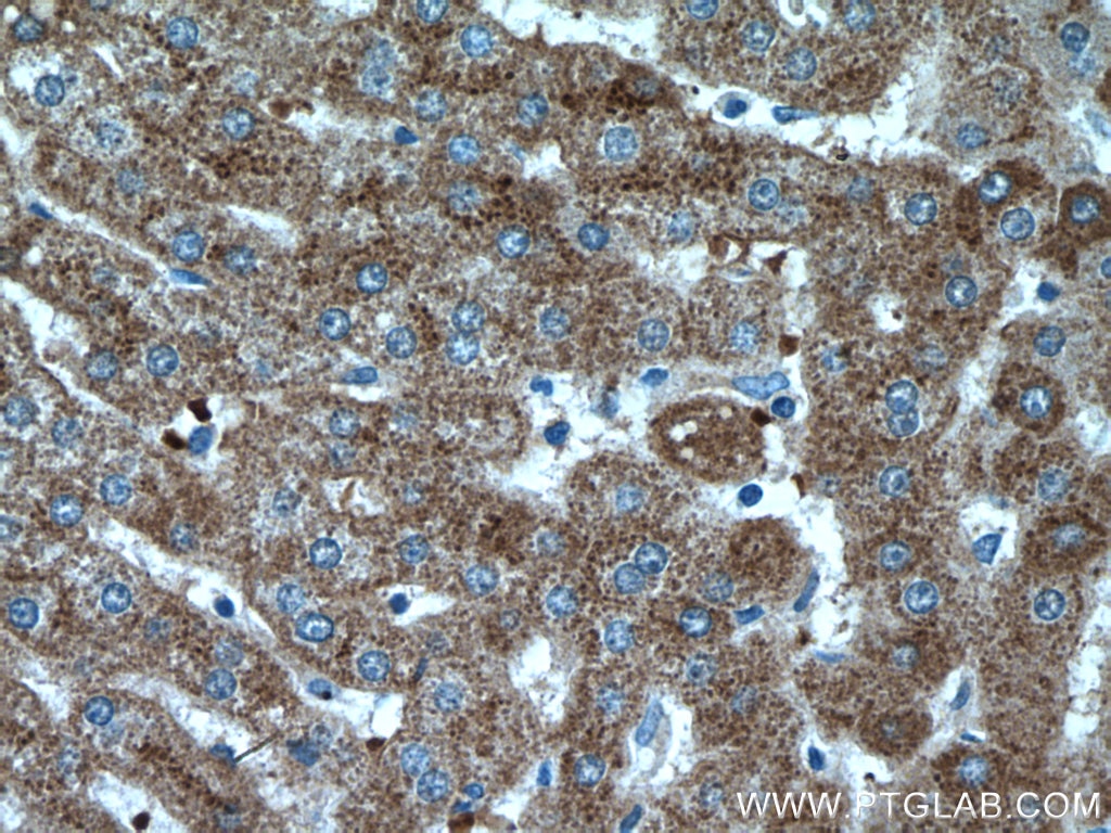 IHC staining of human liver using 16845-1-AP