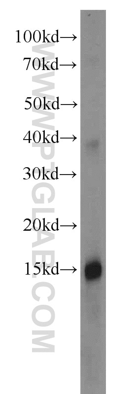 Western Blot (WB) analysis of human plasma using Apolipoprotein A II Polyclonal antibody (16845-1-AP)