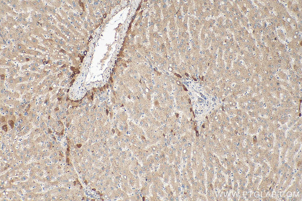 Immunohistochemistry (IHC) staining of human liver tissue using APOA4 Polyclonal antibody (17996-1-AP)