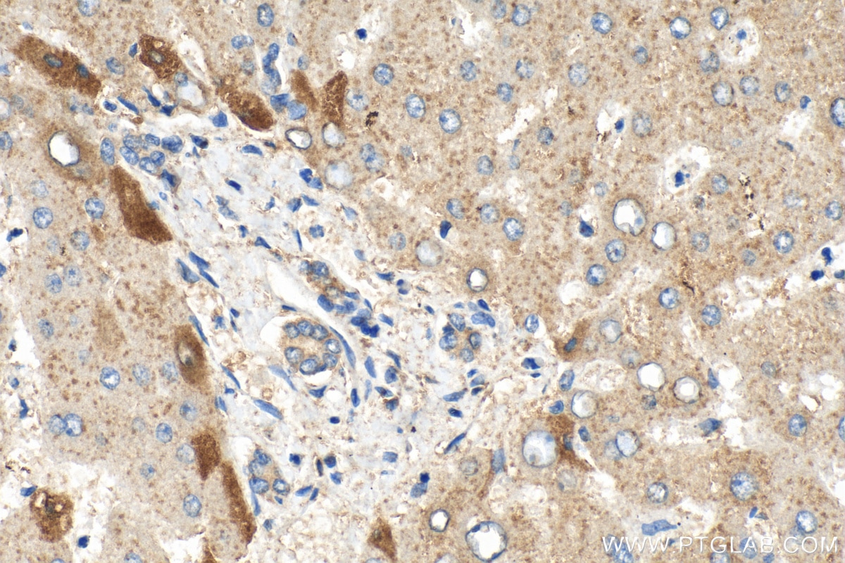 Immunohistochemistry (IHC) staining of human liver tissue using APOA4 Polyclonal antibody (17996-1-AP)