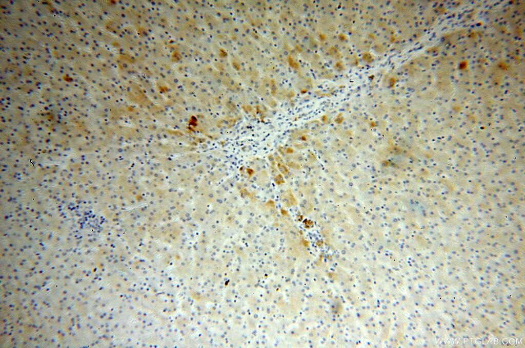 APOA4