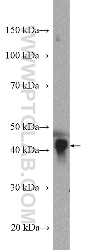 Western Blot (WB) analysis of human plasma using APOA4 Polyclonal antibody (17996-1-AP)