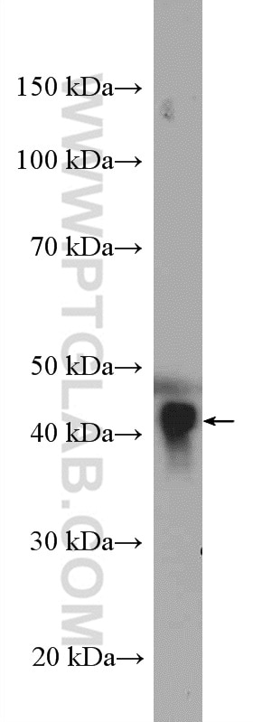 WB analysis of human plasma using 17996-1-AP