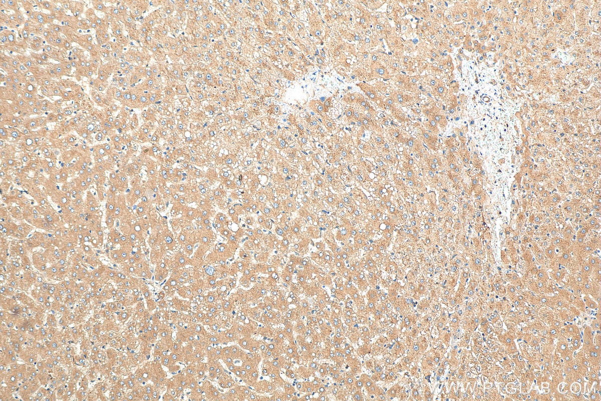 IHC staining of human liver using 20578-1-AP
