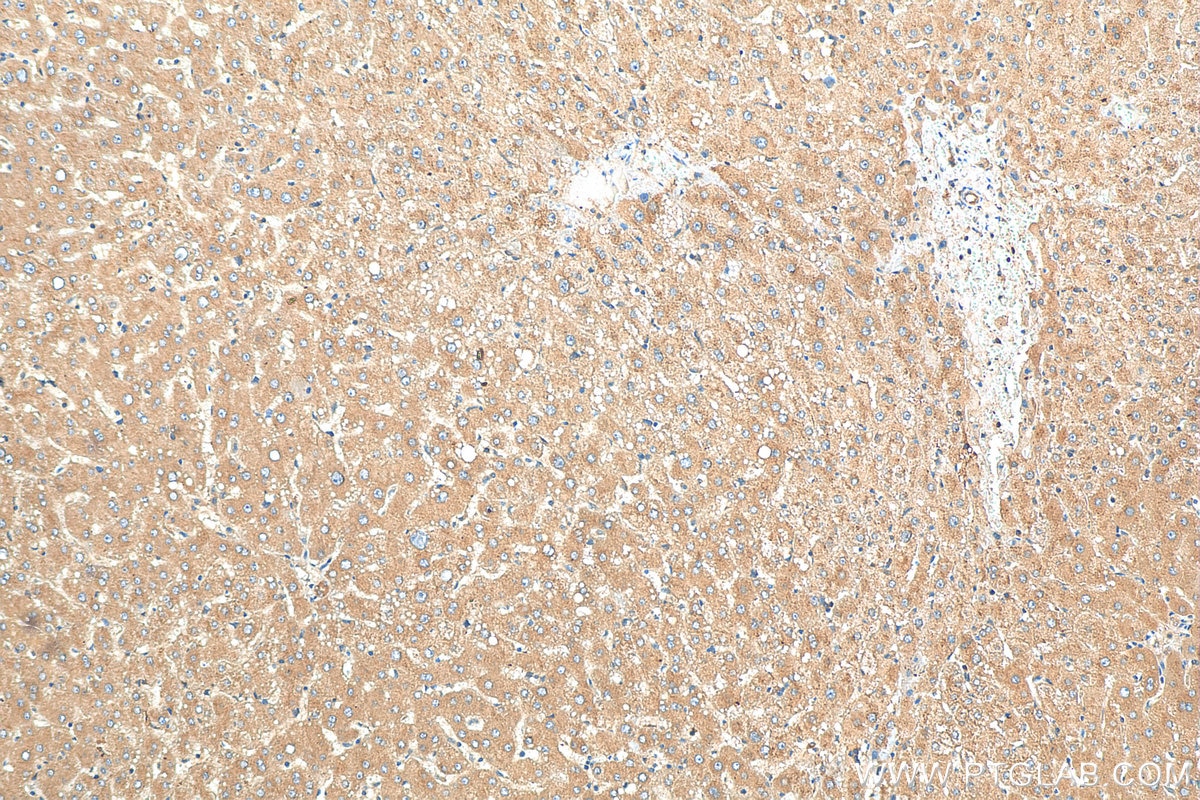 Immunohistochemistry (IHC) staining of human liver tissue using APOB Polyclonal antibody (20578-1-AP)