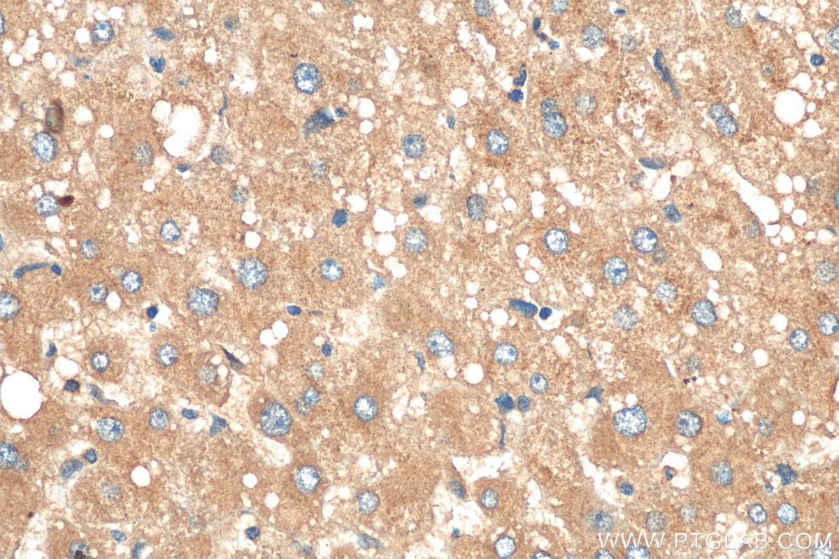 Immunohistochemistry (IHC) staining of human liver tissue using APOB Polyclonal antibody (20578-1-AP)