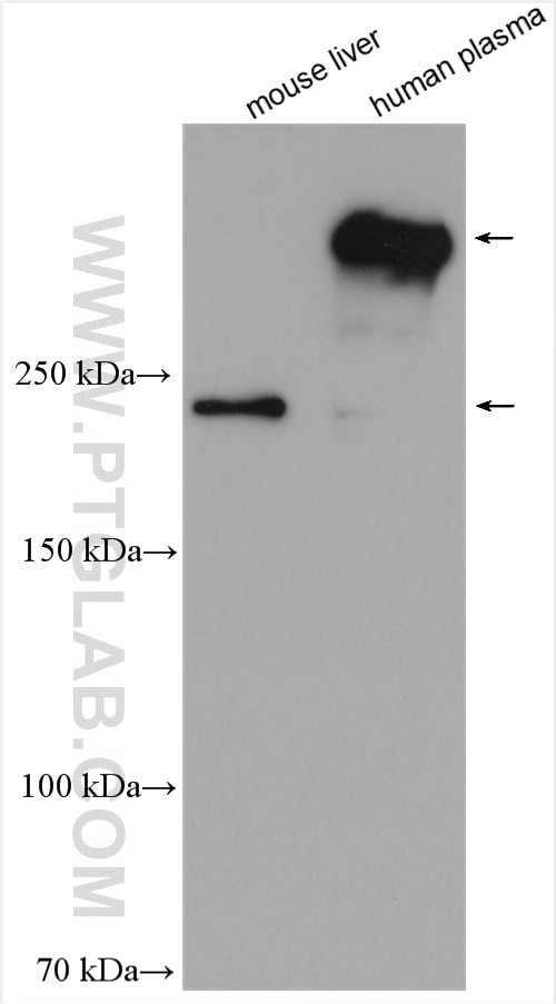 Western Blot (WB) analysis of various lysates using APOB Polyclonal antibody (20578-1-AP)