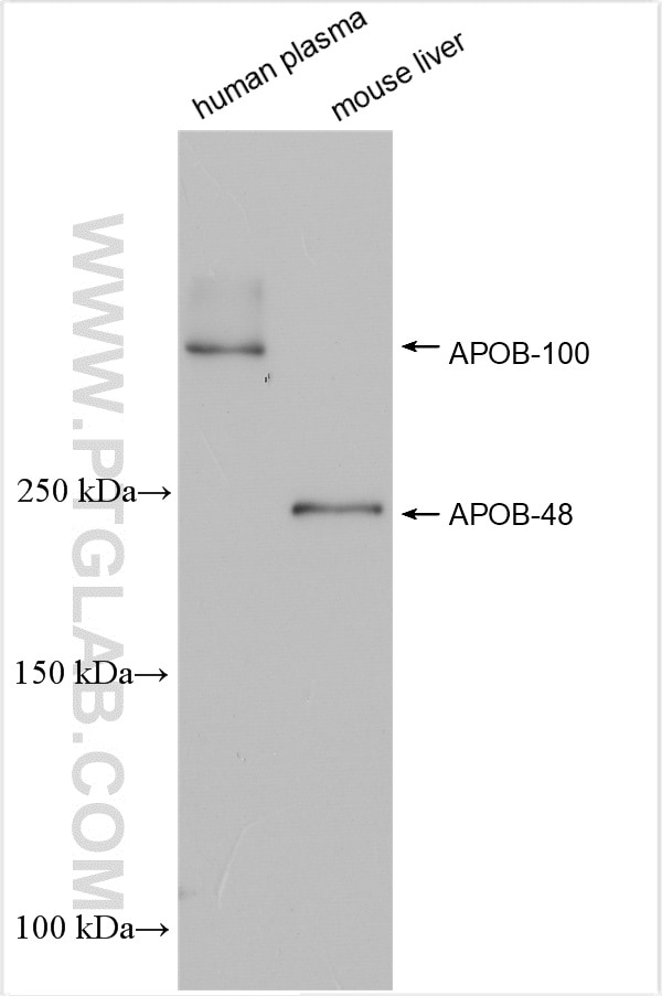 Western Blot (WB) analysis of various lysates using APOB Polyclonal antibody (20578-1-AP)