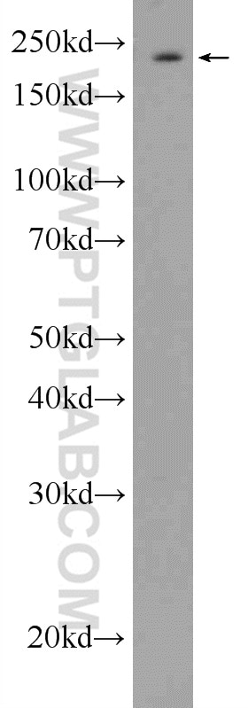 Western Blot (WB) analysis of HEK-293 cells using APOB Polyclonal antibody (20578-1-AP)